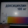 20180227_212852.jpg